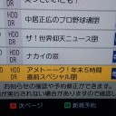 しもやけが、とうとうできた（笑）