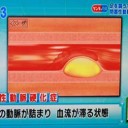 冷え性