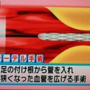 冷え性