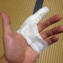【悲報】俺氏、左手を三針縫う【またかよ】