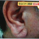 耳たぶのラインは何?！
