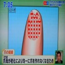 爪とは？！ある病の危険信号と日々の重要な役割がある！！
