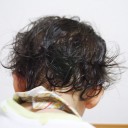 エムラの影響