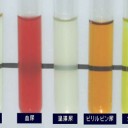 尿の色によって症状が違う！