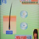 薄毛治療！細胞融合で髪の毛の種を作る！シナモンで薄毛予防！