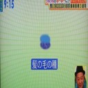 薄毛治療！細胞融合で髪の毛の種を作る！シナモンで薄毛予防！
