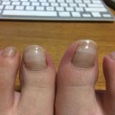 開き直り