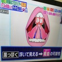 生活習慣によって毛細血管がゴースト化を改善法とは・・・