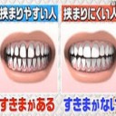 歯の間にモノが「挟まりやすい人」と「挟まりにくい人」