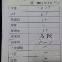 血尿からの尿路結石