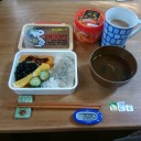 大腸のポリープ（木曜日）♪