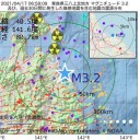 血栓症の有害事象あるアストラゼネカワクチン／大学病院の救急は受け入れを停止してます、