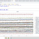 ★【 コロナ 】感染から数か月は【 脳梗塞リスク 】高く★／【 頭痛や不調のリスク 】