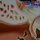 耳アカとは…