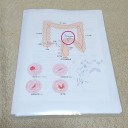 大腸内視鏡カメラ翌日・・・結果報告します。