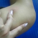 吸い付かれ体質。