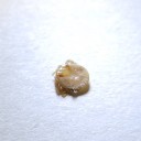 閲覧注意！　マダニの画像
