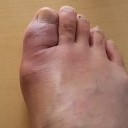 昨日の血液検査の結果が