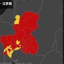 【 糖尿病 と筋膜】／レディー・ガガ 【 線維 筋痛 症 】／筋膜性【疼痛】症候群。　（中rin）