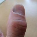 左手の親指