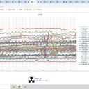 【 陽性 妊婦 】出産 相次ぐ ★／小児の重症、中等症／体内被曝の脅威／悪気のない市民の視線と言動が追い詰め。