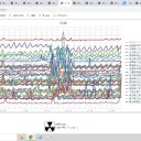 ★【 COVID-19 死産率 上昇 】／デルタ株では ４倍 に上昇する可能性★