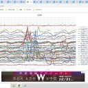 【　世界中の　患者を救う　】